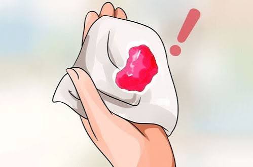 Ra máu nhiều, kéo dài hoặc kèm đau bụng, choáng, sốt là dấu hiệu cần được thăm khám sớm