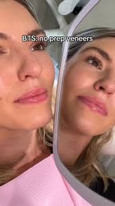 BTS: No Prep Veneers 😁 #veneers #noprepveneers #smilemakeover  #cosmeticdentist #newsmile