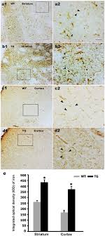 Directory of profiled business people: Mutant Huntingtin Induces Iron Overload Via Up Regulating Irp1 In Huntington S Disease Springerlink