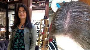 See full list on lorealparisusa.com How To Cope With Grey Hair Go Lighter