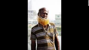 Saying an individual of color must have a white parent in order to have red hair is false. Orange The New Black In Bangladesh