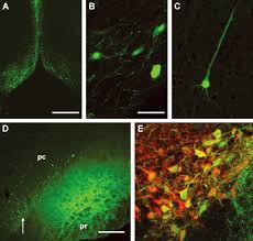 Image result for Poppy Red 1996 AAV