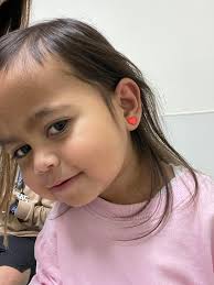 Child needs surgery for object stuck in nose