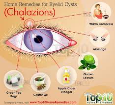 A common way to relieve discomfort from a cyst on the eyelid is to apply warm compresses. Home Remedies For Eyelid Cysts Chalazions Top 10 Home Remedies
