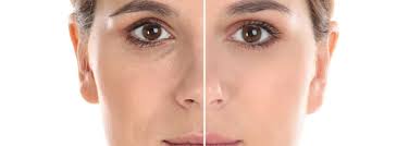 Skin Rejuvenation Treatments at The Laser Treatment Clinic