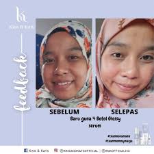 Manja TOP LEADER KINS &KATS