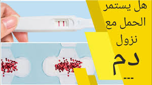 على سبيل المثال، إذا كان أكثر نشاطاً عادة في المساء، فيجب أن يستمر شعورك. ÙÙ ÙÙÙÙ ÙØ³ØªÙØ± Ø§ÙØ­ÙÙ ÙØ¹ ÙØ²ÙÙ Ø§ÙØ¯Ù ÙØ²ÙÙ Ø¯Ù Ø§Ø«ÙØ§Ø¡ Ø§ÙØ­ÙÙ ÙÙ Ø§ÙØ´ÙØ± Ø§ÙØ«Ø§ÙÙ ÙØ²ÙÙ Ø¯Ù Ø§Ø«ÙØ§Ø¡ Ø§ÙØ­ÙÙ Youtube
