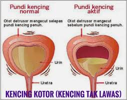 Vitamin / supplement vivix shaklee untuk kencing manis via vitamin2u.net. Atasi Masalah Kencing Kotor Vitaminsoho Com