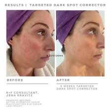 Tara Talks R+F Skincare