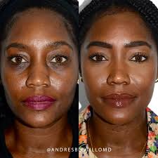 Andres Bustillo, MD, FACS