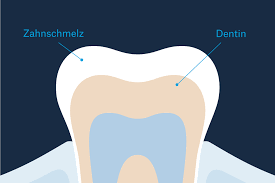 Wann kommen dann die neuen? 7 Fragen Rund Um Bleaching Beantwortet Von Einem Zahnarzt Gently By Curaden
