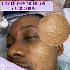 Dra. Zaida Thomas Kelly-Dermatóloga