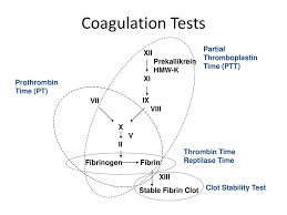 See full list on mayoclinic.org The Diagnostic Approach To Minor Clotting Abnormalities In The Adult Ppt Download