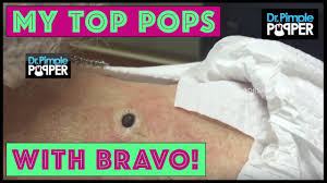 But she told insider that she can't and won't watch those videos at all. Dr Sandra Lee Discusses Her Top Pops With Bravotv Com Youtube