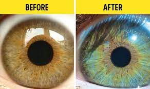 7 Things That Can Change Your Eye Color Bright Side