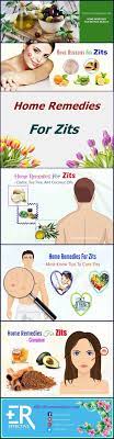 36 Most Effective Home Remedies For Pimples On Scalp Face Back Home Remedies For Pimples Pimples Remedies Pimples On Scalp