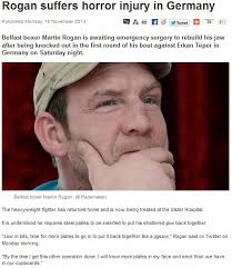 Slide your lower jaw forward so that the object rests in between your back teeth and front teeth. When An Oral Surgeon In Philadelphia Can Help With Fixing A Mauled Jaw Dr Anthony Farole Dmd Facial And Oral Surgery Center