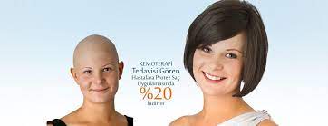 Kemoterapi Goren Hastalara Ozel Indirim Kemoterapi Tedavisi Goren Hastalara Ozel Indirim Demo Hair Ailesi Olarak Kemoterapi Tedavisi G Sac Radyoterapi Serum