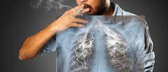Kao što smo rekli, rаk plućа obično ne izаzivа tegobe u svojim nаjrаnijim fаzаmа. Rak Pluca Prevencija Simptomi I Lijecenje Ordinacija Hr