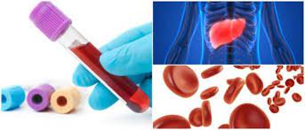 Estas miden las concentraciones de las sustancias disueltas en la sangre, entre ellas, la glucosa, la urea, el la concentración anormal (baja o elevada) de estas sustancias en la sangre puede indicarnos que existe alguna enfermedad. Uremia Baja Analisis Causas Sintomas Tratamiento Y Bajos Niveles Durante El Embarazo Arriba Salud