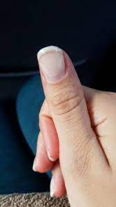 Hierfür gibt es verschiedene methoden, die sich hauptsächlich in zwei bereiche gliedern: Liftings Oben Am Rand Acrylnagel