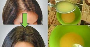 Hizli Sac Uzatan Ve Saclari Gurlestiren Dogal Formul Paylas Herkes Faydalansin Hair Remedies Hair Loss Remedies Hair Treatment