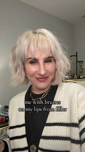 💉💉💉 #fyp #fypppp #lipfiller