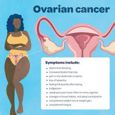 When cancer begins in the ovaries it is called ovarian cancer. Queensland Health Did You Know That Ovarian Cancer Doesn T Always Cause Symptoms Or If It Does They Might Seem Vague Or Similar To Other Conditions If You Ve Noticed The Below Symptoms
