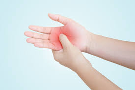 Palmar erythema warmth or burning in both hands may be caused by a rare skin condition called palmar erythema. Palmar Erythema What Causes Reddening Of The Palm How To Treat It