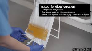 Image result for Urine Output