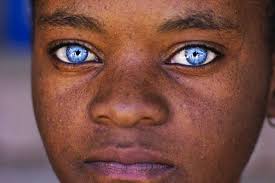 Ini salah satu alasan mengapa lensa kontak berwarna biru demikian berikut ini beberapa fakta tentang warna mata biru yang mungkin belum anda ketahui: 5 Individu Di Dunia Yang Mengalami Sindrom Mata Biru Waardenburg Iluminasi