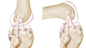 But, this ligament injury can sometimes happen if one leg is stretched out in front of you and doesn't have the. Side Of Knee Pain