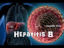 Dokter akan membantu jika anda ingin mengetahui lebih lanjut mengenai cara mencegah penularan hepatitis. Tubuh Merawat Tubuh Penyakit 1