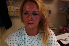 Fundraiser for Rachel Thompson by Thomas Lowell Grimm : For The Love Of Dita