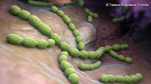 Zuerst einmal muss geklärt werden, wie antibiotika überhaupt wirken. Lungenentzundung Ursachen Anzeichen Therapie Netdoktor