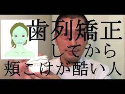 歯列矯正で頬こけ 顔が長くなった 頬骨が出た人のケア方法 顔筋マッサージ方法 ストレッチ方法 原因についてまとめました 歯列矯正 顔のエクササイズ 老け顔