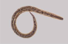 Image result for Strongyloides