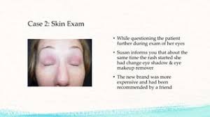 Patch Testing: A to Z