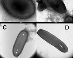 Pandoravirus yedoma