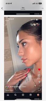 Pwede po kaya mag pa Rhino ang may sinusitis??