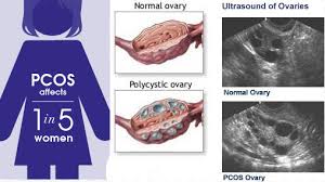 Pemanfaatan sel punca embrionik (embryonic stem cells/escs) penelitian ini membahas gambaran umum dan manfaat sel punca embrionik, serta menganalisisnya berdasarkan pandangan hukum islam. Hanya Setahun Sekali Datang Haid Wanita Ini Kongsi Pengalaman Hidap Pcos