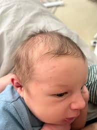 Are these little bumps just baby acne? He has a couple