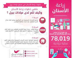 انفوجرافيك عن خطوات زراعة الأسنان لدينا وبعض الاحصائيات الرياض الازدهار 0112632424 المونسيه 0544229299 Abc