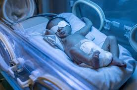 In the us, there are about 106,000 cases per year and about 7,100 people die from it annually. Why It S Best Not To Worry If Your Baby Has Jaundice Cleveland Clinic