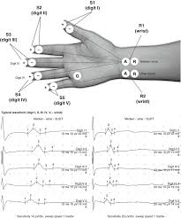 In a major scale, you have the following names for each degree Digit I Ii Iii Iv V Wrist Springerlink