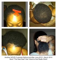 Black hair has a number of enemies, such as wind, rain, central heating and air conditioning, and vitamins can be used to rectify the resulting damage. Nzuri Elixir Hair Liquid Vitamin Goes Straight To Work Unlike Pills And Tablets Grow Your Own Hair 150 To 200 In Just 90 Days