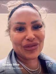 Darcey 'Lost Her Mind' In Latest Procedure! Her head is shaped like a  triangular pick shovel.”🙄😟.....Check video below #90day