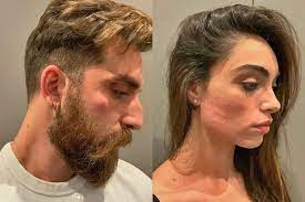 Analisi completa dei dati instagram di lorella boccia. Lorella Boccia E Niccolo Presta Stanno Bene Aggrediti Da Alcuni Malviventi