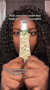 Effective Cica Cream for Acne and Sensitive Skin