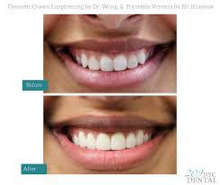 Wei is a top nyc dentist specializing in cosmetic dentistry with smile makeovers for that perfect smile. Dr Ben Ifraimov Cosmetic Dentist 209 Nyc Dental